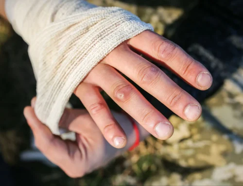 Ataque animal en California | Abogado de mordeduras de perro en Sacramento