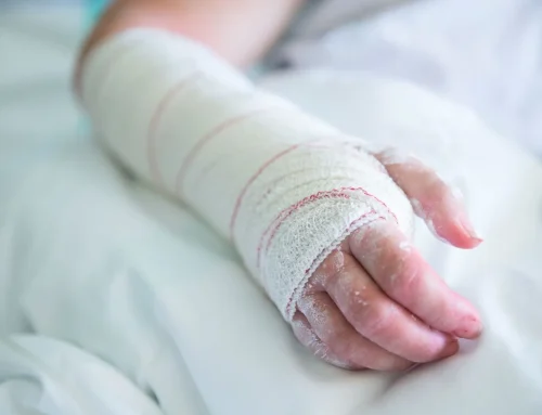 Mordedura de perro en Sacramento: pasos inmediatos